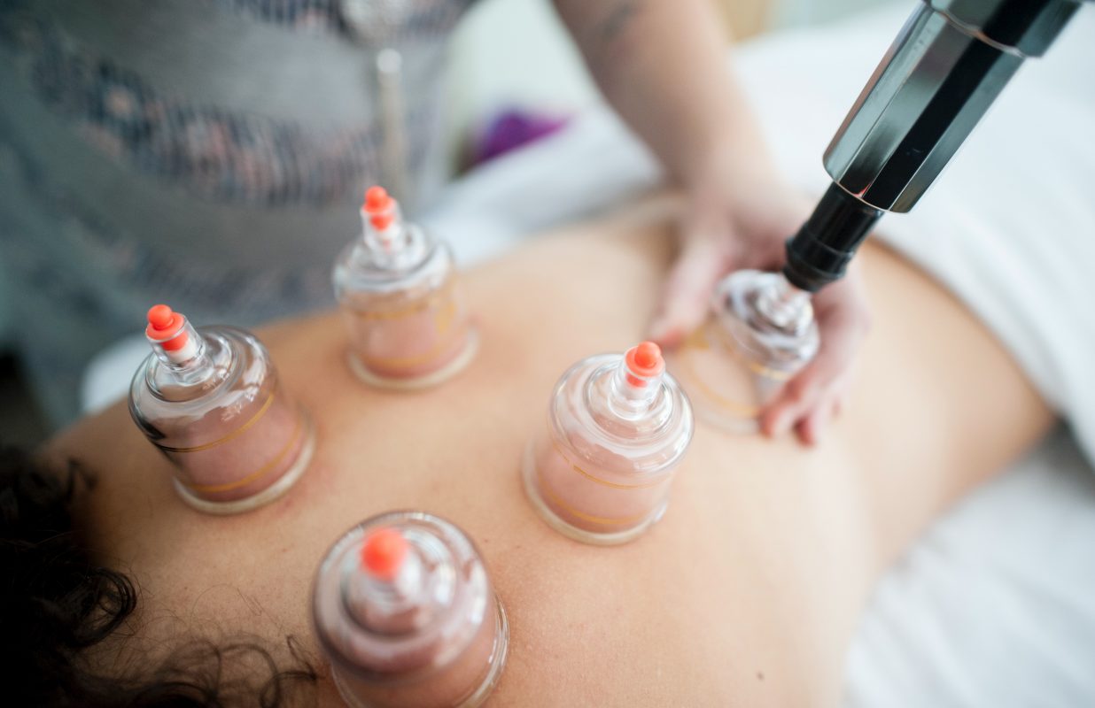 cupping therapy, massage,